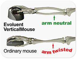 VM4-skeletons-sm1